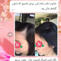 روغن تراپی|آرایشی، بهداشتی، درمانی|اهواز, عامری|دیوار