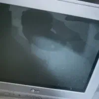 تلوزیون 21اینچ کاملا سالم