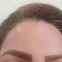 آموزش ژل و بوتاکس تضمینی|خدمات آموزشی|ایذه, |دیوار