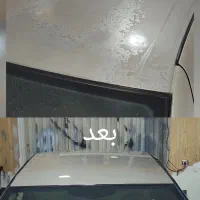 رفع آفتاب سوختگی ،پولیش واکس لیسه با قیمت منصفانه