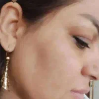 کرم معجزه شب|آرایشی، بهداشتی، درمانی|گنبد کاووس, |دیوار