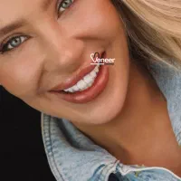 دندانپزشکی (بدون تراش) لمینت کامپوزیت ایمپلنت
