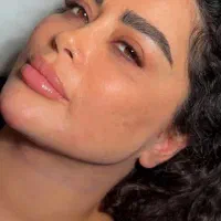 لیپو ساکشن غبغب متدی وی لاین تزریق چربی بوکال فت|خدمات زیبایی و سلامت|شیراز, عفیفآباد|دیوار