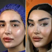 پی آر پی (prp) بایوفیلر اگزوزوم ژل فیلربادی بوتاکس|خدمات آرایشگری و زیبایی|کرج, گوهردشت|دیوار