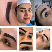 آموزش رایگان ژل بوتاکس کاشت مو و ابرو