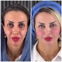 طبیعی10سال جوان شو/فقط تافردا490ت/با20خدمات رایگان
