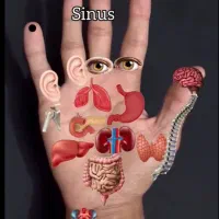 چکاپ کلی خدمات زیبایی طب سنتی حجامت زالو بادکش فصد|خدمات آرایشگری و زیبایی|اصفهان, برازنده|دیوار