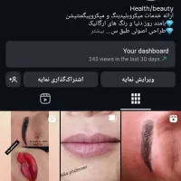 میکروبلیدینگ و میکروپیگمنتیشن