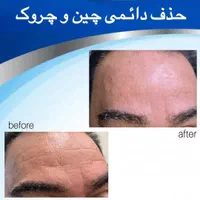 مرکز مراقبت پوست مو لاغری رشت|خدمات آرایشگری و زیبایی|رشت, گلباغ نماز|دیوار