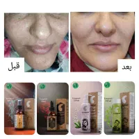 تونیک ضدلک آریا|آرایشی، بهداشتی، درمانی|شیراز, آبزنگی|دیوار