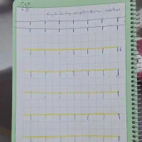 آموزش تخصصی ابتدایی متوسطه اتیسم