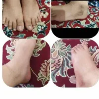 کرم اماراتی عصل مروه گلی|آرایشی، بهداشتی، درمانی|میبد, |دیوار