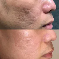 مدل فیشیالcip با دستگاه آنالیز دار و هوش مصنوعی|خدمات آرایشگری و زیبایی|کرج, گلشهر|دیوار