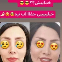 پک معجزه چاقی صورت