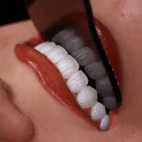 دندانپزشکی نگارام|خدمات آرایشگری و زیبایی|قم, بکایی|دیوار
