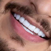 خدمات زیبایی ژل وبوتاکس