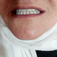 دندان masnoee|خدمات آرایشگری و زیبایی|بهار, |دیوار