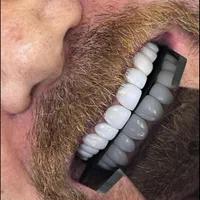 جشنواره خدمات زیبایی دندان با افر 60٪ از دست ندید|خدمات آرایشگری و زیبایی|بابل, |دیوار