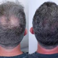 کافئین میتونه
