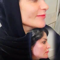 تزریق ژل بوتاکس مزو نخ جوانساز باقیمت مناسب درمنزل|خدمات آرایشگری و زیبایی|شهرضا, |دیوار