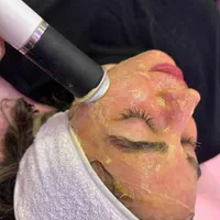 مرکز زیبایی و لیزر نوژا (تخفیف پلاژن تراپی )