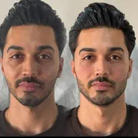 جشنواره ی پاییزه ی فیلر وبوتاکس|خدمات آرایشگری و زیبایی|ارومیه, |دیوار