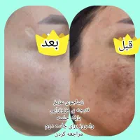 انجام خدمات اقا و خانم|خدمات آرایشگری و زیبایی|اهواز, ۳۰ متری|دیوار