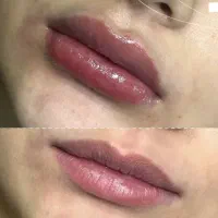 استخدام بیماریاب زیبایی با پورسانت عالی