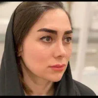 کاشت ابرو، شقیقه، سر، نقدو. اقساط