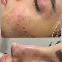 خدمات ژل عربی ‌خلیجی زیبادرکلینیک|خدمات آرایشگری و زیبایی|پرند, فاز ۵|دیوار