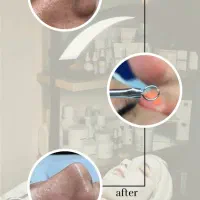 فیشیال تخصصی باموادبرندمخصوص بانوان|خدمات آرایشگری و زیبایی|میبد, |دیوار