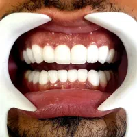 خدمات دندانپزشکی برلیان