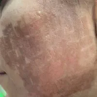 پانسمان هوشمندنانوفیبرتمام گیاهی باسرعت درمان بالا|آرایشی، بهداشتی، درمانی|مشهد, هفت تیر (حافظ)|دیوار