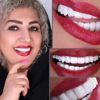 ایمپلنت بلندمدت/کامپوزیت/لمینت/درمانی