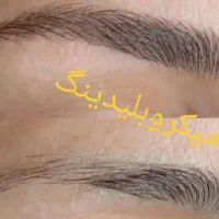 خدمات میکروبلیدینگ فیبروز