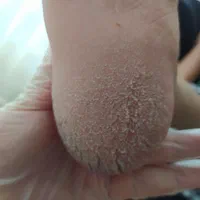 کاشت ناخن و پدیکور تخصصی در گلشهر|خدمات آرایشگری و زیبایی|کرج, گلشهر|دیوار