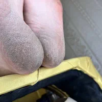 پدیکور تخصصی و درمانی|خدمات آرایشگری و زیبایی|باسمنج, |دیوار