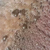 ز،گیل تبخ،،ال