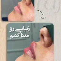 تولید محتوا پست و استوری ویدیو عکس شبکه اجتماعی|خدمات رایانه‌ای و موبایل|کرمانشاه, |دیوار