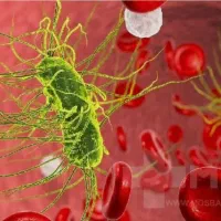 برای کیست و عفونت (بانوان و آقایان)