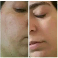 کرم معجزه دست ساز|آرایشی، بهداشتی، درمانی|ساری, |دیوار