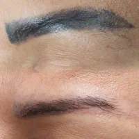 پاک کردن تاتو های قدیمی
