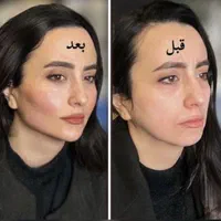 مدل فیشیالcip با دستگاه آنالیز دار و هوش مصنوعی|خدمات آرایشگری و زیبایی|کرج, گلشهر|دیوار