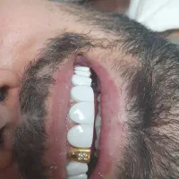 بهیکدنداپزشکباپروانهوکدنظامپزشکینیازمندیم