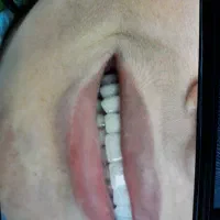 منشی و دستیار خانم جهت مطب دندانپزشکی|استخدام درمانی، زیبایی، بهداشتی|تهران, شهرآرا|دیوار
