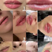 ژل بوتاکس مزوتراپی جوانساز فشیال پاکسازی|خدمات آرایشگری و زیبایی|اندیشه, اندیشه فاز ۱|دیوار