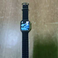 اسمارت واچ