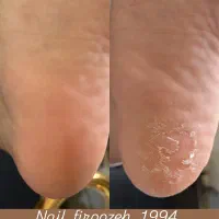 پدیکور تخصصی پا با تخفیف ویژه|خدمات آرایشگری و زیبایی|رشت, گلسار|دیوار