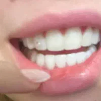 پذیرش نیروی خانم جهت کار در دندانپزشکی
