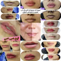 جشنواره کلینیک زیبایی دکتر فهیمه اربابی|خدمات آرایشگری و زیبایی|زابل, |دیوار